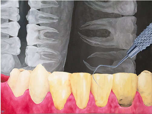 painting of teeth and gums