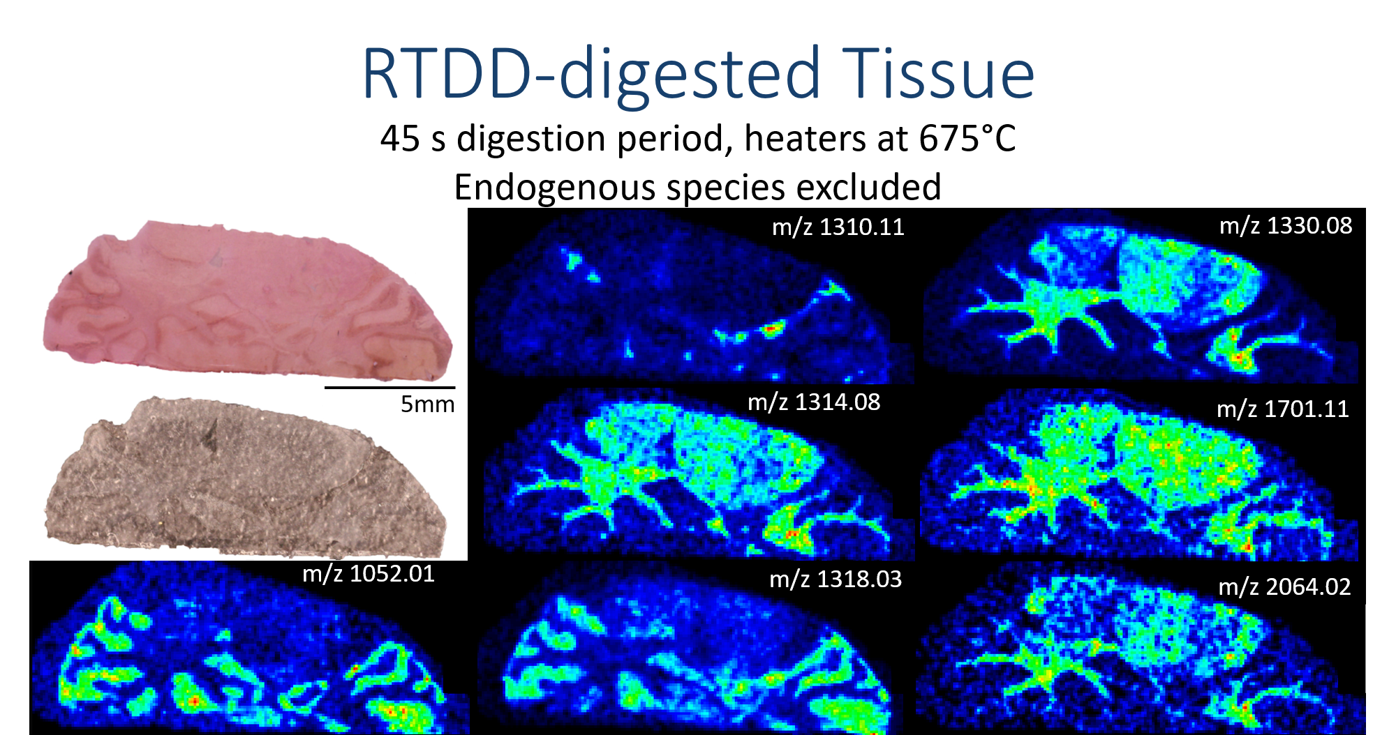 tdd_digest_brain_ims.png