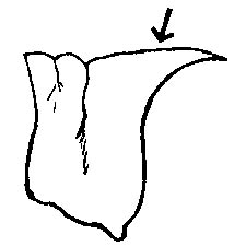 Lateral view of pronotum (disregard arrow).