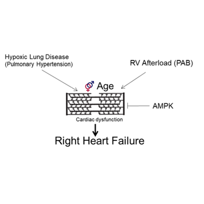 right heart failure diagram 2