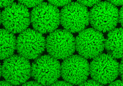 Sea Urchin Shaped Nanoparticles