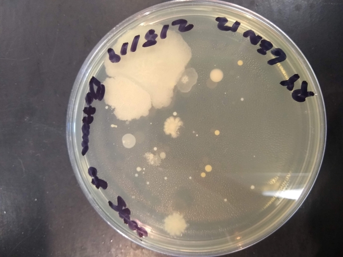 TSA plate with multiple bacterial colonies 