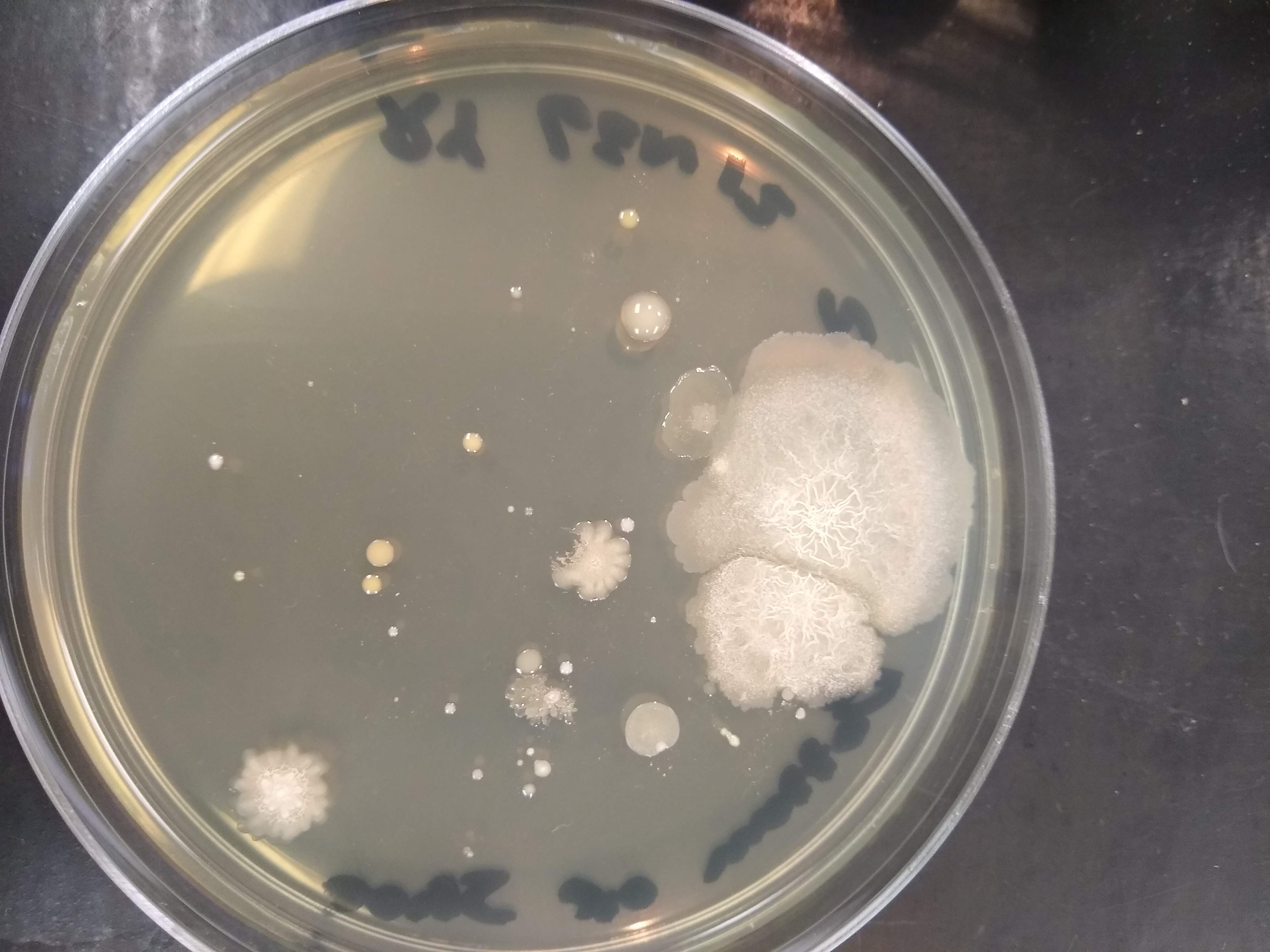 TSA plate with multiple bacterial colonies 