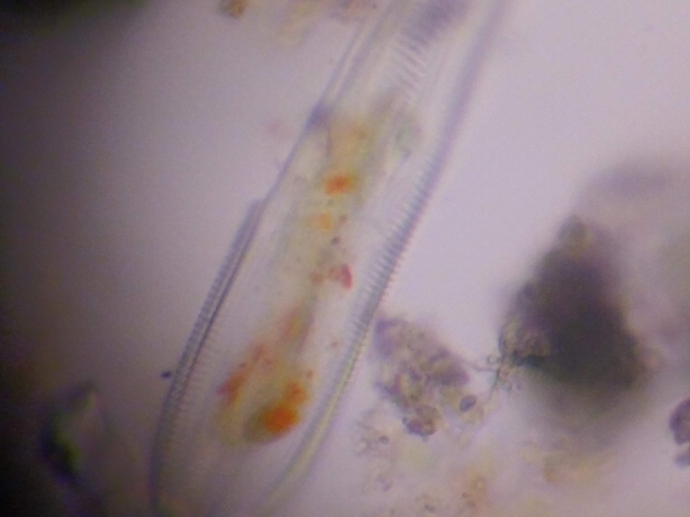 pond water organism at 400x total magnification