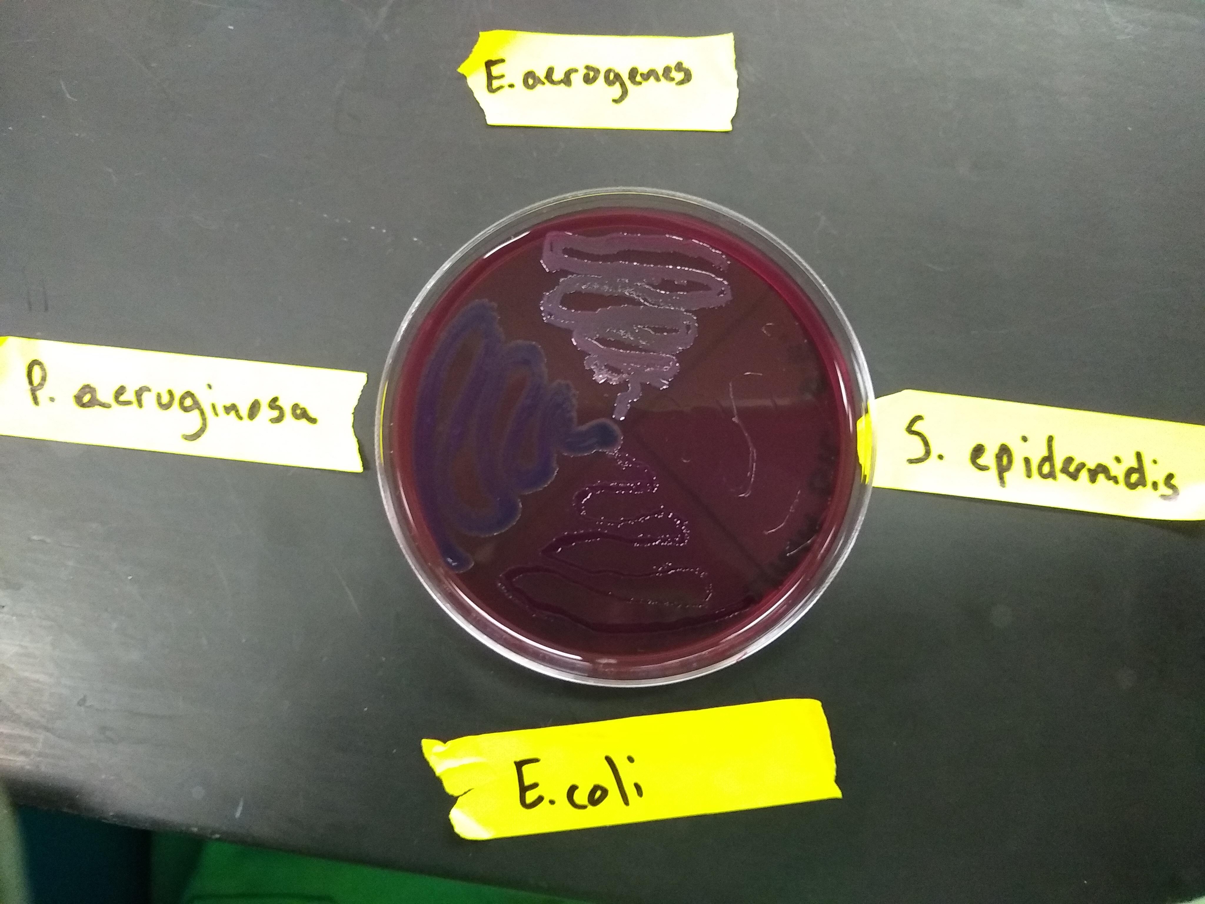EMB plate with all organisms