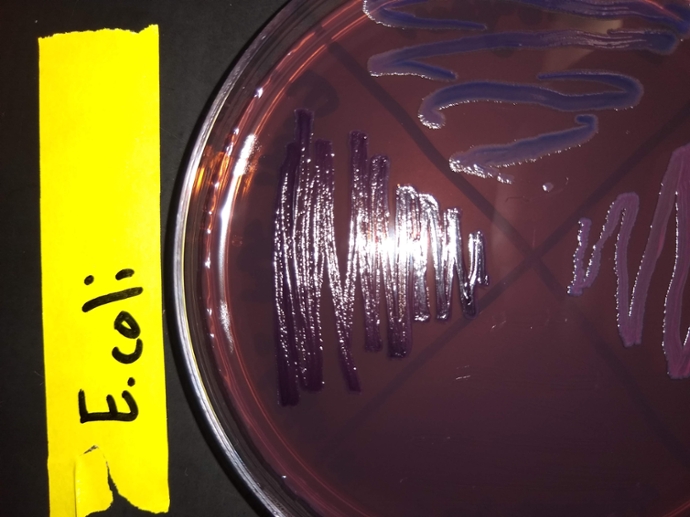 EMB plate with E. coli with metallic sheen