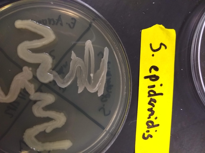 TSA plate with Staphylococcus epidermidis