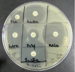 Kirby Bauer results for E. coli