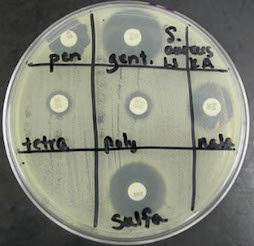 Kirby Bauer results for S. aureus