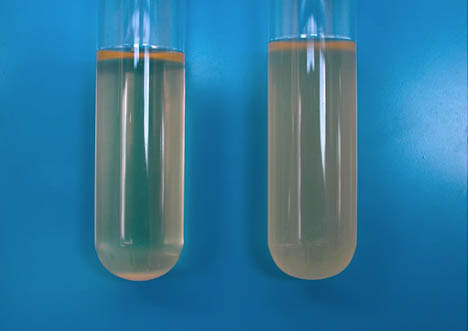 Broth tubes with and without streptomycin