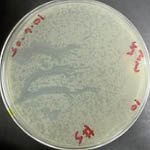phage plate with plaques