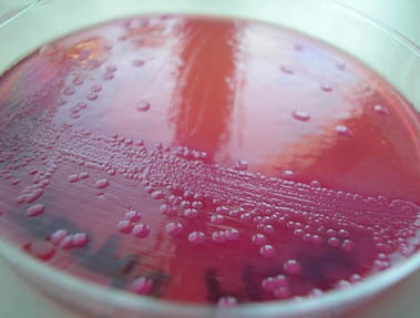 MacConkey MUG plate with pink colonies