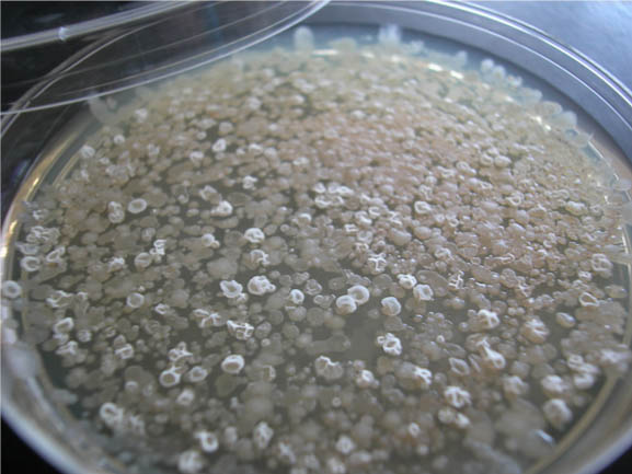 TSA plate with white and gray colonies