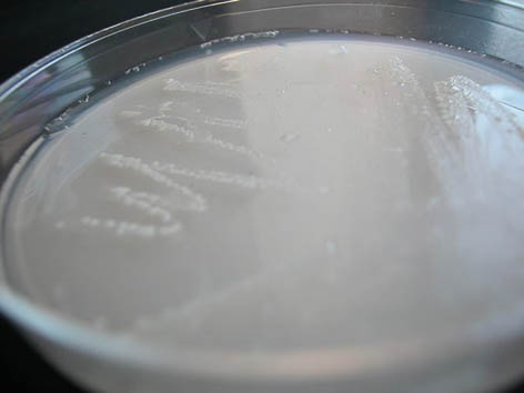 azotobacter colonies on a nitrogen free medium
