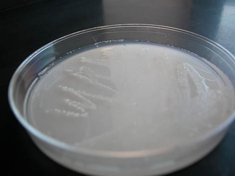 azotobacter colonies on a nitrogen free medium