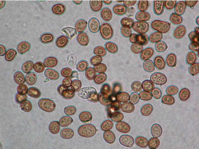 Basidiomycota wet mounts 1000x magnification