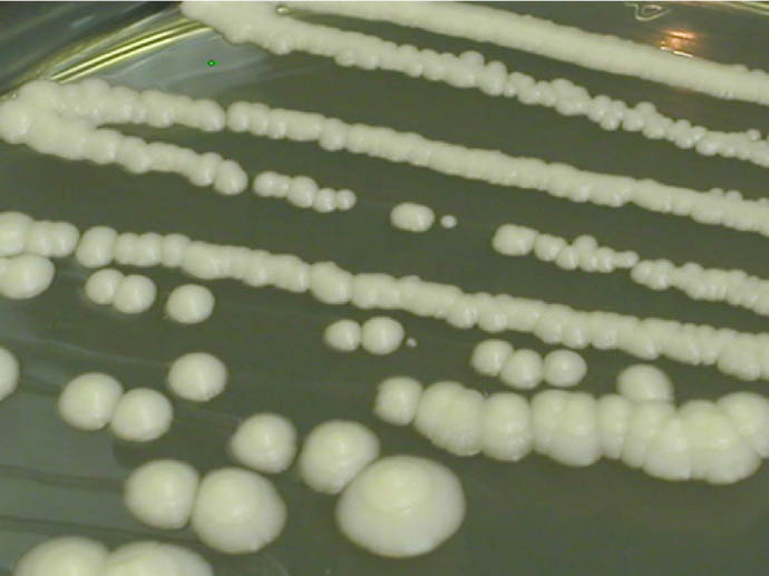 Saccharomyces cerevisiae colonies
