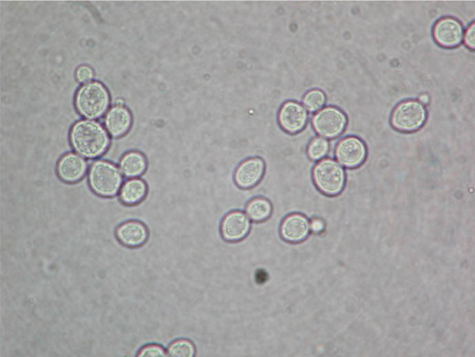 Saccharomyces cerevisiae cells on wet mount