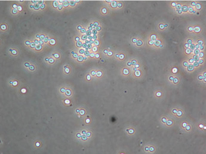 Saccharomyces cerevisiae cells on wet mount
