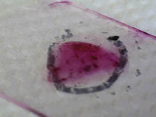 slide with red stained smear