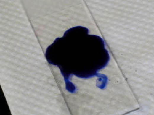 slide covered with blue stain