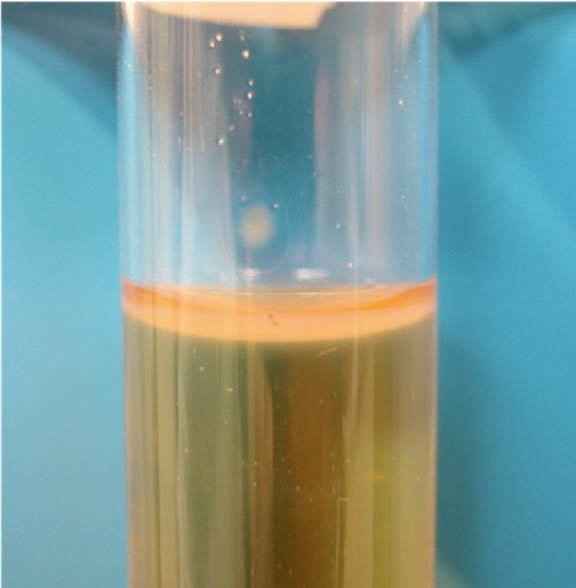 tube growth of Campylobacter jejuni