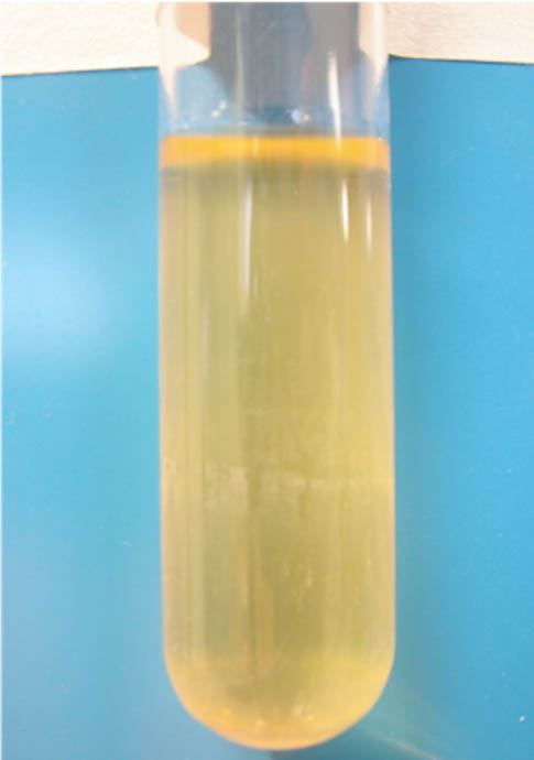 tube growth of Clostridium sordelli