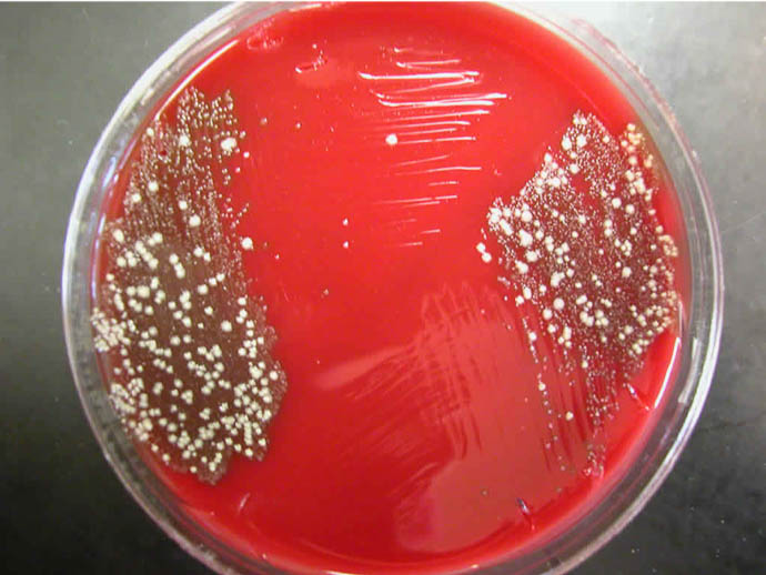 blood agar plate with throat microbes growing