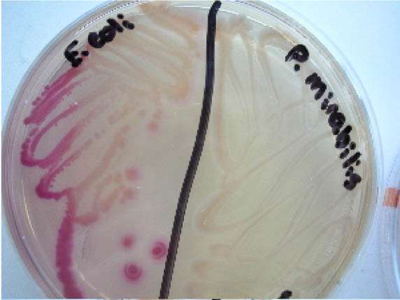 MacConkey plate with E. coli