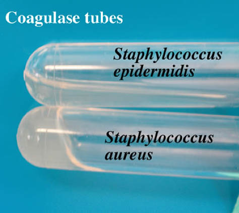 Coagulase tubes inoculated with S. epidermidis and S. aureus