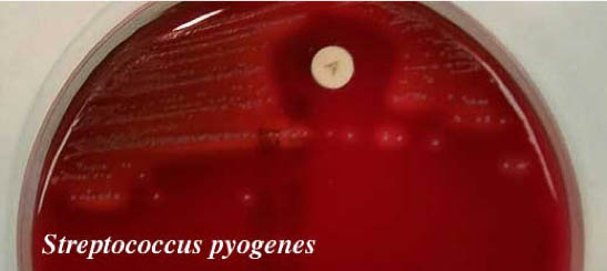 Taxos A Strep pyogenes sensistive