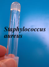 staph aureus