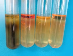 Sulfur Indole Motility Media