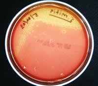 Picture of Alpha Hemolysis