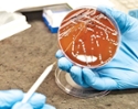 bacterial culture plate