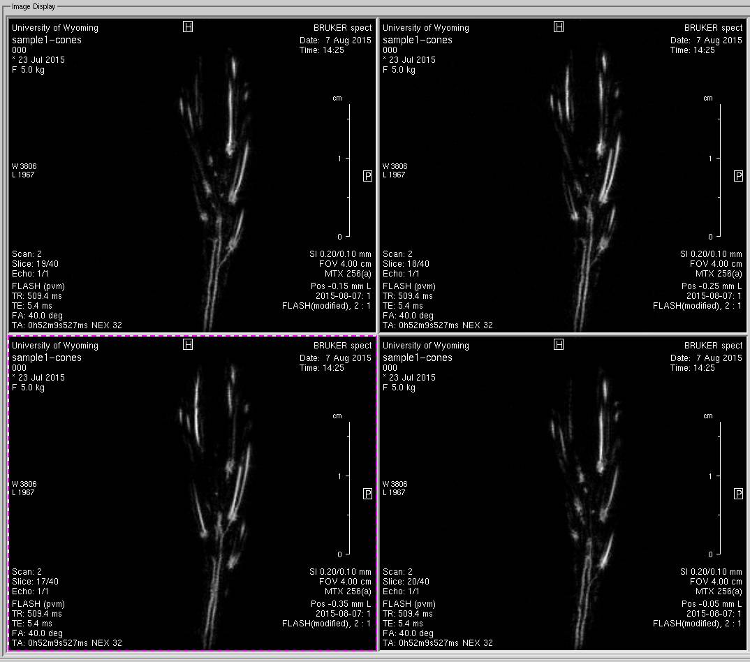 mri-cone