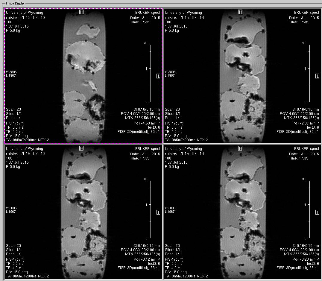 mri-raisins