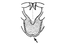 Melanoplus angustipennis (Top View)