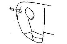 ""