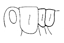 Tegmina and wing pads pointed down (ventrally). 