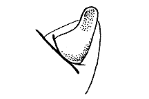 Melanoplus dawsoni