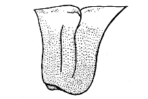 Side view of pronotum (median carina cut near middle).