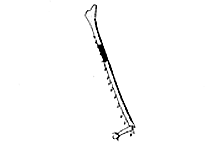 Hind tibia, showing medial black annulation.