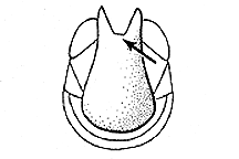 Subgenital plate (note deep notch).