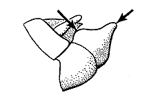 End of male abdomen (note large preapical tubercle). 