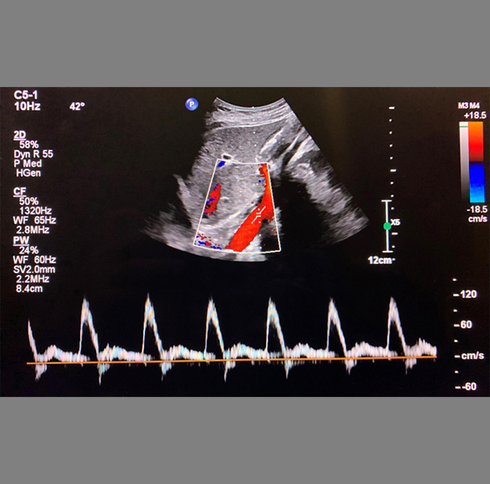 Ultrasound image
