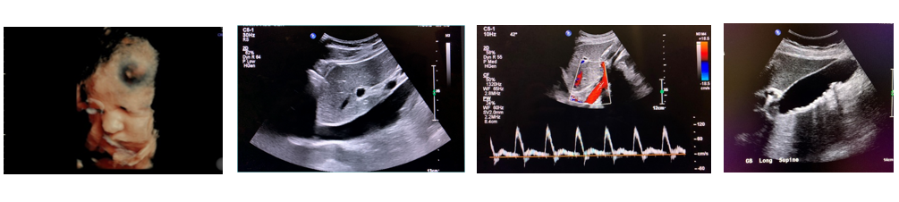Ultrasound Images