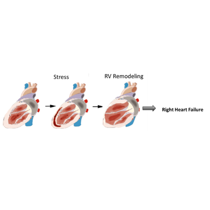 right heart failure diagram 