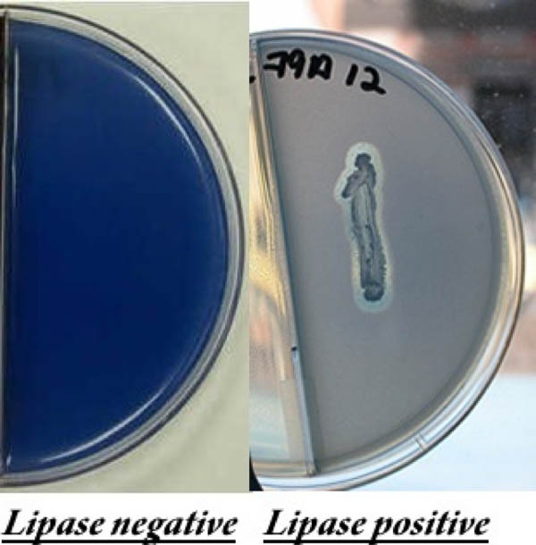 Spirit Blue agar | Summary of Biochemical Tests | Additional Info ...