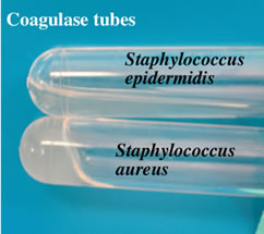 coagulase tubes